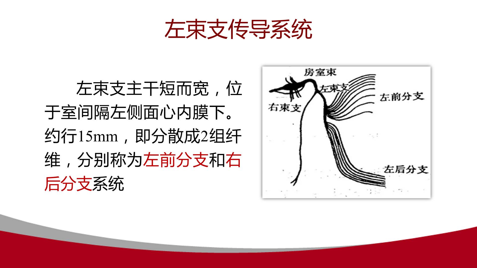 【连载】心电图的实用解析-2左束支阻滞合并心肌梗死心电图