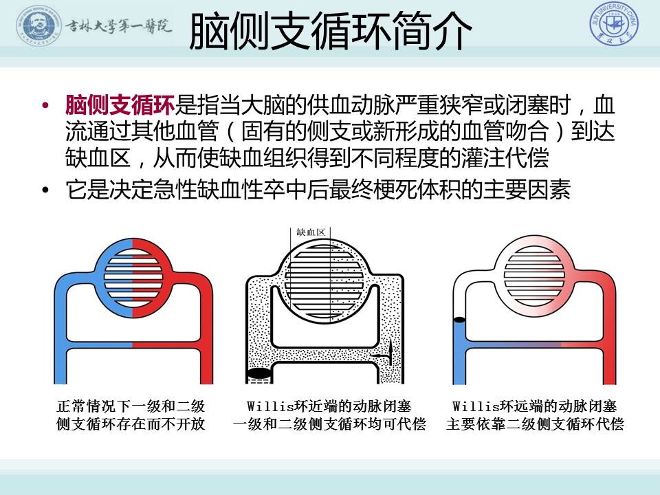 【连载】3脑侧支循环建立的重要性与评估技术-常见脑血管病的规范化