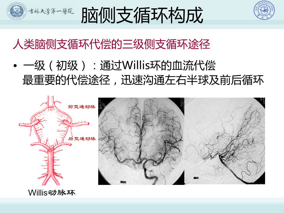 【连载】3脑侧支循环建立的重要性与评估技术-常见脑血管病的规范化