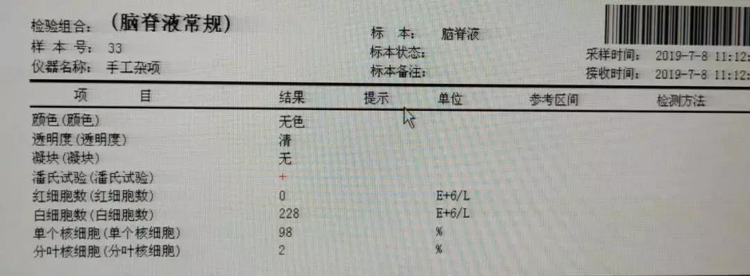 脑脊液检查怎么看?一文分析腰椎穿刺后的脑脊液检查!