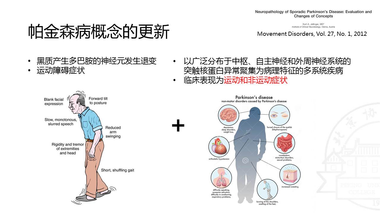 【连载】1帕金森病非运动症状的管理-帕金森病的多