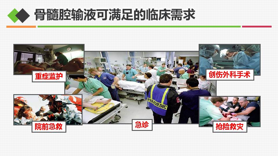 连载骨髓腔输液在危重症患者救治中应用3骨髓腔输液的具体操作