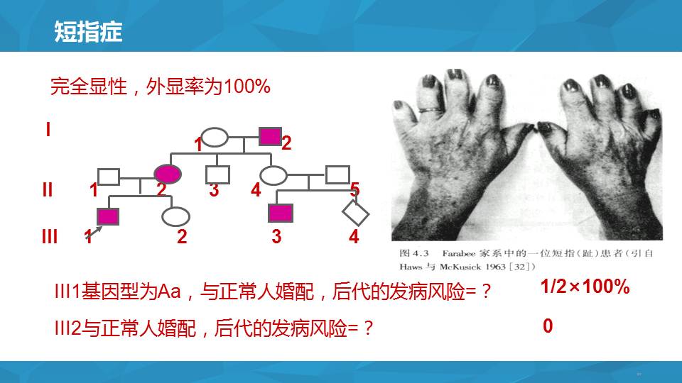常见遗传病及其防治研究进展3单基因遗传病