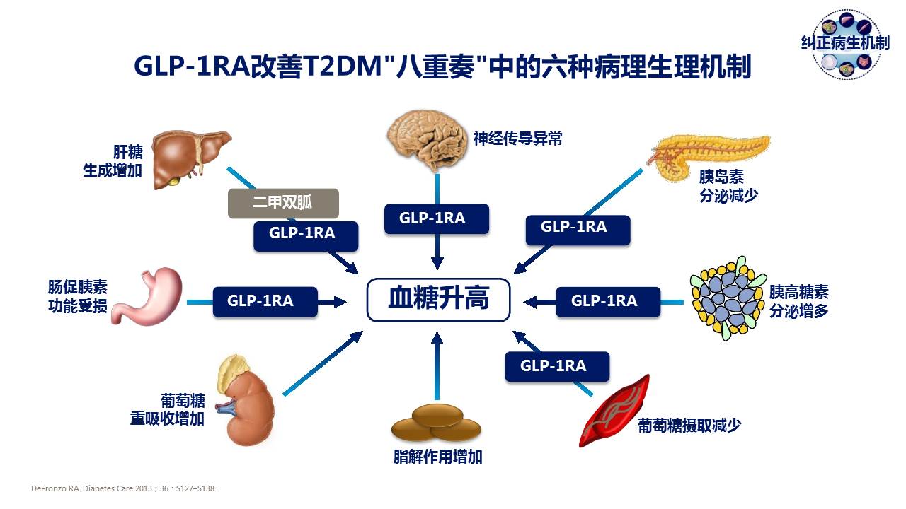 【連載】4糖尿病進展盤點-糖尿病及其微血管併發症干預策略