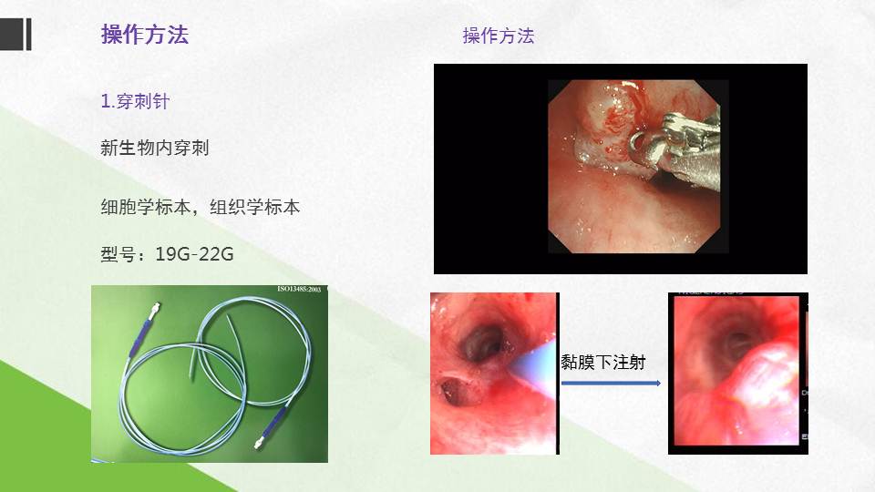 连载3支气管镜下黏膜活检刷检和肺泡灌洗技术操作注意事项支气管镜